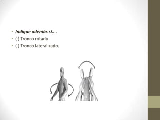 • Indique además si....
• ( ) Tronco rotado.
• ( ) Tronco lateralizado.
 