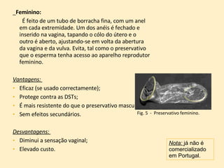 _ Feminino:   É feito de um tubo de borracha fina, com um anel em cada extremidade. Um dos anéis é fechado e inserido na vagina, tapando o cólo do útero e o outro é aberto, ajustando-se em volta da abertura da vagina e da vulva. Evita, tal como o preservativo que o esperma tenha acesso ao aparelho reprodutor feminino. Vantagens:  Eficaz (se usado correctamente); Protege contra as DSTs; É mais resistente do que o preservativo masculino;  Sem efeitos secundários. Desvantagens:  Diminui a sensação vaginal;  Elevado custo. Nota:  já não é comercializado em Portugal. Fig. 5  -  Preservativo feminino. 
