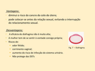 Vantagens:  diminui o risco do cancro do colo do útero;  pode colocar-se antes da relação sexual, evitando a interrupção do relacionamento sexual. Desvantagens: A eficácia do diafragma não é muito alta; A mulher tem de se sentir à vontade consigo própria; Riscos de:  odor fétido;  corrimento vaginal;  aumento do risco de infecção do sistema urinário.  Não protege das DSTs Fig. 7  – Diafragma . 
