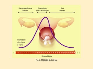 Fig.3 -  Método  de Billings. 
