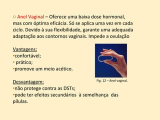 Anel Vaginal  – Oferece uma baixa dose hormonal, mas com óptima eficácia. Só se aplica uma vez em cada ciclo. Devido à sua flexibilidade, garante uma adequada adaptação aos contornos vaginais. Impede a ovulação Vantagens:   confortável; prático;  promove um meio acético.  Desvantagem:   não protege contra as DSTs;  pode ter efeitos secundários  à semelhança  das pílulas. Fig. 12 – Anel vaginal . 