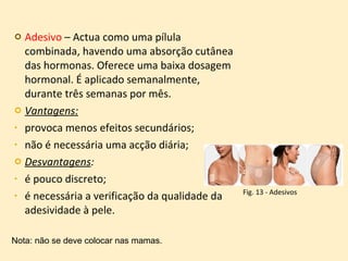 Adesivo  – Actua como uma pílula combinada, havendo uma absorção cutânea das hormonas. Oferece uma baixa dosagem hormonal. É aplicado semanalmente, durante três semanas por mês. Vantagens:   provoca menos efeitos secundários; não é necessária uma acção diária; Desvantagens :  é pouco discreto;  é necessária a verificação da qualidade da adesividade à pele.  Nota: não se deve colocar nas mamas. Fig. 13 - Adesivos 