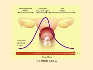 Fig.3 -  Método  de Billings. 