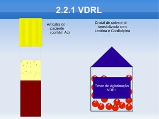 2.2.1 VDRL
         Amostra do     Cristal de colesterol
          paciente        sensibilizado com
          (contém Ac)   Lecitina e Cardiolipina




Y YYY
 Y Y Y

YY Y Y
    Y                   A    A               A

                        A
                        Teste de Aglutinação
                               VDRL         A
                        A
                             A              A
                        A           A
                          A     A A A A
 