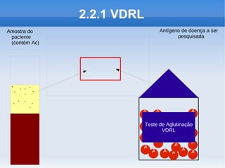 2.2.1 VDRL
Amostra do                       Antígeno de doença a ser
 paciente                               pesquisada
 (contém Ac)




 Y YYY
  Y Y Y

 YY Y Y
     Y                                        A
                        A    A

                        A
                        Teste de Aglutinação
                               VDRL         A
                        A
                             A              A
                        A           A
                           A    A A A A
 