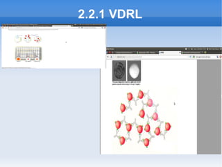 2.2.1 VDRL
 