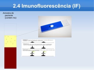2.4 Imunofluorescência (IF)
Amostra do
 paciente
 (contém Ac)




 Y Y
  Y  Y
         Y
   Y Y
  Y    Y
 