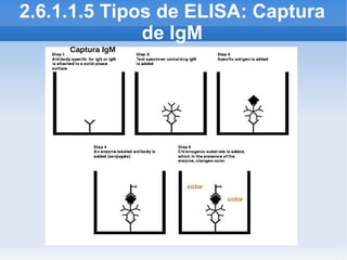 2.6.1.1.5 Tipos de ELISA: Captura
              de IgM
     Captura IgM
 