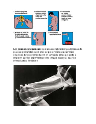 Los condones femeninos son unos recubrimientos delgados de
plástico poliuretano con aros de poliuretano en extremos
opuestos. Estos se introducen en la vagina antes del coito e
impiden que los espermatozoides tengan acceso al aparato
reproductivo femenino
 