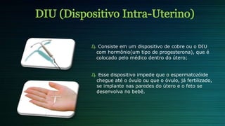 ₯ Consiste em um dispositivo de cobre ou o DIU
com hormônio(um tipo de progesterona), que é
colocado pelo médico dentro do útero;
₯ Esse dispositivo impede que o espermatozóide
chegue até o óvulo ou que o óvulo, já fertilizado,
se implante nas paredes do útero e o feto se
desenvolva no bebê.
 