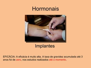 Hormonais Implantes  EFICÁCIA: A eficácia é muito alta. A taxa de gravidez acumulada até 3 anos foi de  zero , nos estudos realizados  até o momento . 