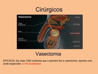 Cirúrgicos Vasectomia  EFICÁCIA: De cada 1000 mulheres que o parceiro fez a vasectomia, apenas uma pode engravidar.  0,1% de chances 