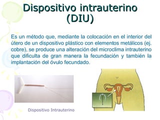 Dispositivo intrauterino (DIU) Es un método que, mediante la colocación en el interior del útero de un dispositivo plástico con elementos metálicos (ej. cobre), se produce una alteración del microclima intrauterino que dificulta de gran manera la fecundación y también la implantación del óvulo fecundado.                       Dispositivo Intrauterino 