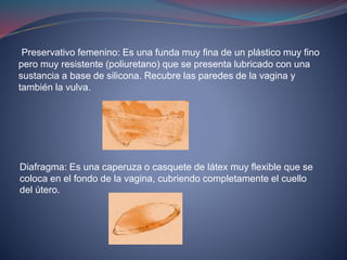 Preservativo femenino: Es una funda muy fina de un plástico muy fino
pero muy resistente (poliuretano) que se presenta lubricado con una
sustancia a base de silicona. Recubre las paredes de la vagina y
también la vulva.
Diafragma: Es una caperuza o casquete de látex muy flexible que se
coloca en el fondo de la vagina, cubriendo completamente el cuello
del útero.
 
