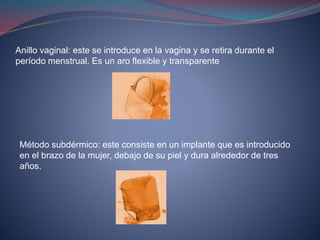 Anillo vaginal: este se introduce en la vagina y se retira durante el
período menstrual. Es un aro flexible y transparente
Método subdérmico: este consiste en un implante que es introducido
en el brazo de la mujer, debajo de su piel y dura alrededor de tres
años.
 