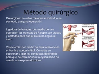 Quirúrgicos: en estos métodos el individuo es
sometido a alguna operación.
Ligadura de trompas: por medio de una
operación las trompas de Falopio son atadas
y cortadas para que el óvulo no llegue al
útero.
Vasectomía: por medio de esta intervención
el hombre queda infértil. Consiste en
seccionar y ligar los conductos deferentes
para que de esta manera la eyaculación no
cuente con espermatozoides.
Método quirúrgico
 