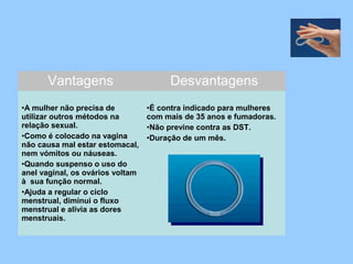Vantagens Desvantagens
•A mulher não precisa de
utilizar outros métodos na
relação sexual.
•Como é colocado na vagina
não causa mal estar estomacal,
nem vómitos ou náuseas.
•Quando suspenso o uso do
anel vaginal, os ovários voltam
à sua função normal.
•Ajuda a regular o ciclo
menstrual, diminui o fluxo
menstrual e alivia as dores
menstruais.
•É contra indicado para mulheres
com mais de 35 anos e fumadoras.
•Não previne contra as DST.
•Duração de um mês.
 