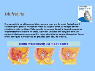 Diafragma É uma capinha de silicone ou látex, macia e com aro de metal flexível que é colocada pela própria mulher no fundo da vagina, antes da relação sexual, cobrindo o colo do útero. Este método forma uma barreira, impedindo que os espermatozóides entrem no útero. Deve ser utilizado em conjunto com um espermicida (componente químico capaz de matar os espermatozóides), dessa forma assegura a prevenção da gravidez com 98% de eficácia. Como introduzir um diafragma 