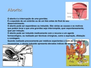 Aborto: O aborto é a interrupção de uma gravidez. É a expulsão de um embrião ou de um feto antes do final do seu desenvolvimento. O aborto pode ser espontâneo ou induzido. São várias as causas e os motivos que podem levar a que uma gravidez seja interrompida, quer espontaneamente, quer por indução. O aborto pode ser induzido medicamente com o recurso a um agente farmacológico, ou realizado por técnicas cirúrgicas, como a aspiração,   dilatação e curetagem. Quando realizado precocemente por médicos experientes e  com as condições  necessárias, o aborto induzido apresenta elevados índices  de seguranç a   