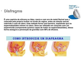 Métodos contraceptivos humanos