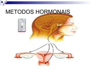METODOS HORMONAIS 