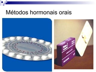 Métodos hormonais orais 
