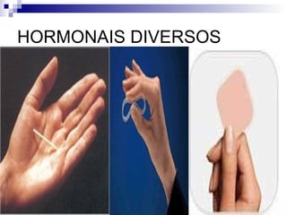HORMONAIS DIVERSOS 