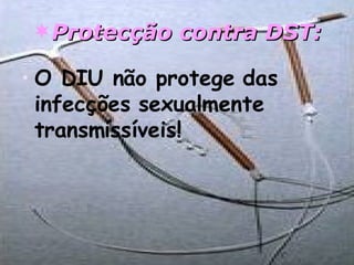 Protecção contra DST: O DIU não protege das infecções sexualmente transmissíveis! 