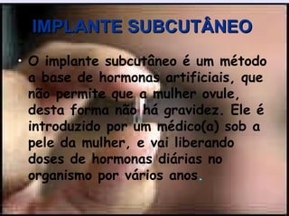 IMPLANTE SUBCUTÂNEO   O   implante subcutâneo é um método a base de hormonas artificiais, que não permite que a mulher ovule, desta forma não há gravidez. Ele é introduzido por um médico(a) sob a pele da mulher, e vai liberando doses de hormonas diárias no organismo por vários anos .      