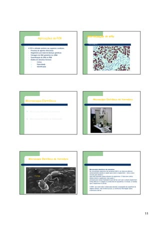 11
Aplicações da PCR
ll A PCRA PCR éé utilizada tambutilizada tambéém nas seguintes condim nas seguintes condiçções:ões:
•• PresenPresençça de agentes infecciososa de agentes infecciosos
•• DiagnDiagnóóstico prstico préé--natal de doennatal de doençças genas genééticasticas
•• Clonagem de DNA genômico ouClonagem de DNA genômico ou cDNAcDNA
•• QuantificaQuantificaçção de DNA ou RNAão de DNA ou RNA
•• AnAnáálise de amostras forenseslise de amostras forenses
ll CrimesCrimes
ll PaternidadePaternidade
ll IdentificaIdentificaççãoão
Hibridização in situ
“É uma técnica utilizada para identificar mRNA(ou DNA) em amostras
de tecido humano e animal em conjunto com aspectos
morfológicos”.
EBER In Situ Hybridization (DAB)
(Nasopharyngeal Carcinoma) / EBV
Microscopia Eletrônica
ll Microscopia Eletrônica de VarreduraMicroscopia Eletrônica de Varredura
ll Microscopia Eletrônica de TransmissãoMicroscopia Eletrônica de Transmissão
Microscópio Eletrônico de Varredura
Microscopia Eletrônica de Varredura
Formiga
Microscópio eletrônico de varredura
No microscópio eletrônico de varredura (MEV) um feixe de elétrons
extremamente estreito é usado para varrer o espécimen – isto é, ele é
movido para diante e
para trás enquanto passa através do espécimen. O feixe tem vários
efeitos sobre o espécimen, dos quais o
principal para nossa finalidade é que ele faz com que o próprio espécimen
emita elétrons. A imagem é construída em sequência, no tempo, à medida
que o espécimen é varrido.
O MEV, por outro lado, é ideal para estudar a topografia de superfície de
objetos sólidos, mas fornece pouca, ou nenhuma informação sobre
a estrutura interna
 