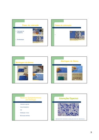 9
Fases da coloração
l Coloração do
citoplasma
l Desidratação
Fases da coloração
l Diafanização ou
clarificação
Montagem da lâmina
Montagem da lâmina
Técnicas Complementares
em Patologia
• Colorações especiais
• Imuno-histoquímica
• PCR
• Hibridização “in situ”
• Microscopia eletrônica
Colorações EspeciaisColorações Especiais
Mycobacterium tuberculosis corado pela técnica de Ziehl-NeelsenMycobacterium tuberculosis corado pela técnica de Ziehl-NeelsenFNFN
 