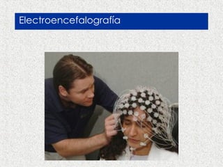 What is Cognitive Neuroscience? Electroencefalografía 