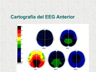 Cartografía del EEG Anterior 