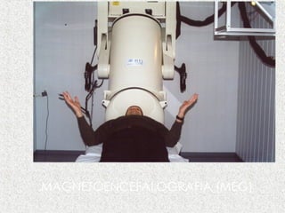 MAGNETOENCEFALOGRAFIA (MEG) 