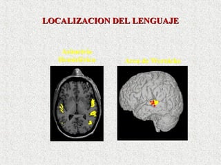 LOCALIZACION DEL LENGUAJE Asimetría Hemisférica Area de Wernicke 