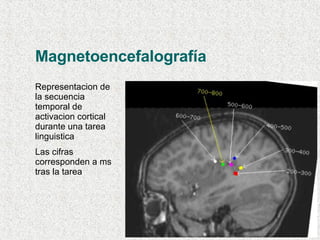 Magnetoencefalografía Representacion de la secuencia temporal de activacion cortical durante una tarea linguistica Las cifras corresponden a ms tras la tarea 