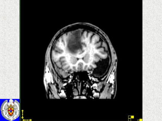 4/ Centro de Magnetoencefalografía   “ Dr. Pérez Modrego” 