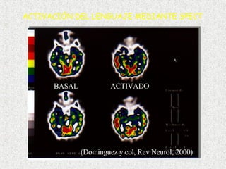 BASAL ACTIVADO ACTIVACIÓN DEL LENGUAJE MEDIANTE SPECT (Dominguez y col, Rev Neurol, 2000) 
