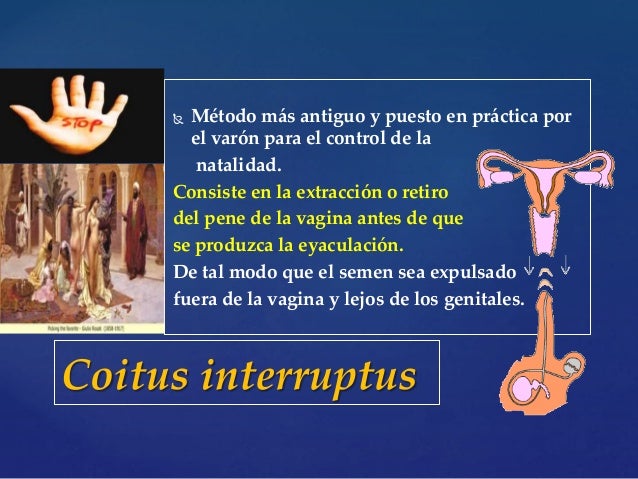 La operación al miembro viril antes y después