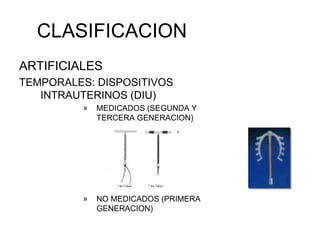 CLASIFICACION ARTIFICIALES  TEMPORALES: DISPOSITIVOS INTRAUTERINOS (DIU) MEDICADOS (SEGUNDA Y TERCERA GENERACION) NO MEDICADOS (PRIMERA GENERACION) 