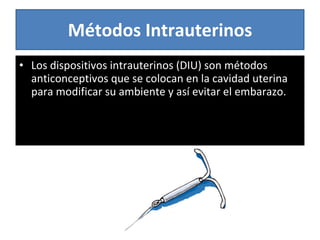 Métodos Intrauterinos Los dispositivos intrauterinos (DIU) son métodos anticonceptivos que se colocan en la cavidad uterina para modificar su ambiente y así evitar el embarazo.  