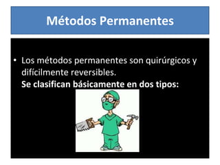 Métodos Permanentes Los métodos permanentes son quirúrgicos y difícilmente reversibles.  Se clasifican básicamente en dos tipos: 