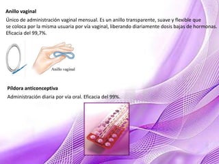 Anillo vaginal
Único de administración vaginal mensual. Es un anillo transparente, suave y flexible que
se coloca por la misma usuaria por vía vaginal, liberando diariamente dosis bajas de hormonas.
Eficacia del 99,7%.
Píldora anticonceptiva
Administración diaria por vía oral. Eficacia del 99%.
 