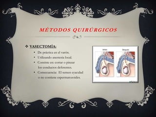 MÉTODOS QUIRÚRGICOS

 VASECTOMÍA:
   • De práctica en el varón.
   • Utilizando anestesia local.
   • Consiste en: cortar o pinzar
     los conductos deferentes.
   • Consecuencia: El semen eyaculad
     o no contiene espermatozoides.
 
