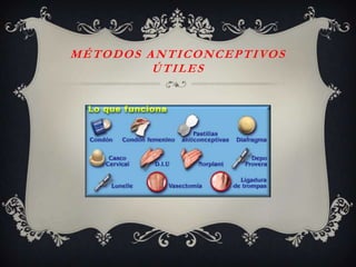 M É T O D O S A N T I C O N C E P T I VO S
               ÚTILES
 