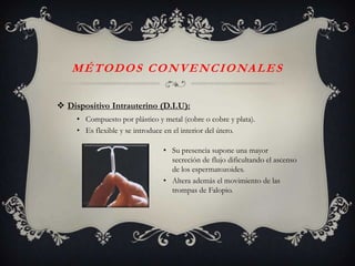 M É T O D O S C O N V E N C I O NA L E S

 Dispositivo Intrauterino (D.I.U):
     • Compuesto por plástico y metal (cobre o cobre y plata).
     • Es flexible y se introduce en el interior del útero.

                                • Su presencia supone una mayor
                                  secreción de flujo dificultando el ascenso
                                  de los espermatozoides.
                                • Altera además el movimiento de las
                                  trompas de Falopio.
 