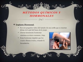 MÉTODOS QUÍMICOS Y
             H O R M O NA L E S

 Implante Hormonal:
    • Son seis pequeños tubos del tamaño de una cerilla que se insertan
      debajo de la piel del brazo de la mujer.
    • Liberan lentamente hormonas
      sintéticas en dosis constante y baja.
    • Estas hormonas impiden que los
      ovarios liberen óvulos, evitando la
      fecundación.
 
