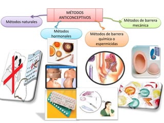 Métodos anticonceptivos