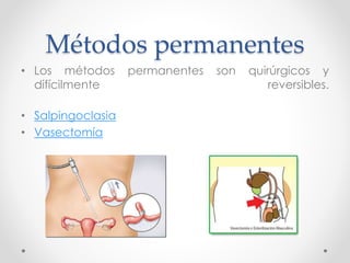 Métodos permanentes 
• Los métodos permanentes son quirúrgicos y 
difícilmente reversibles. 
• Salpingoclasia 
• Vasectomía 
 
