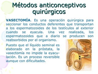 Métodos anticonceptivosMétodos anticonceptivos
quirúrgicosquirúrgicos
VASECTOMÍA. Es una operación quirúrgica para
seccionar los conductos deferentes que transportan
a los espermatozoides de los testículos al exterior
cuando se eyacula. Una vez realizada, los
espermatozoides que a diario se producen son
reabsorbidos por el organismo.
Puesto que el líquido seminal es
elaborado en la próstata, la
vasectomía no impide la eyacu-
lación. Es un proceso reversible
aunque con dificultades.
 